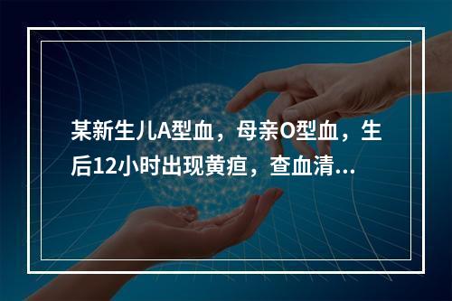 某新生儿A型血，母亲O型血，生后12小时出现黄疸，查血清胆红