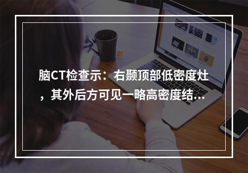 脑CT检查示：右颞顶部低密度灶，其外后方可见一略高密度结节，