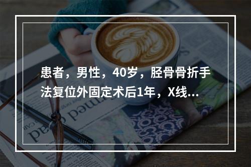 患者，男性，40岁，胫骨骨折手法复位外固定术后1年，X线片提