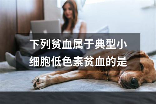 下列贫血属于典型小细胞低色素贫血的是