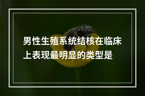 男性生殖系统结核在临床上表现最明显的类型是