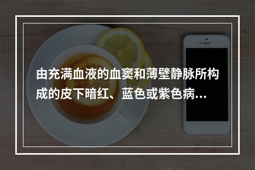 由充满血液的血窦和薄壁静脉所构成的皮下暗红、蓝色或紫色病灶是