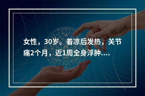 女性，30岁。着凉后发热，关节痛2个月，近1周全身浮肿.尿少