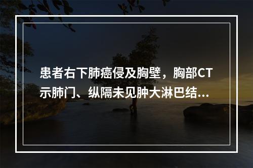 患者右下肺癌侵及胸壁，胸部CT示肺门、纵隔未见肿大淋巴结，未