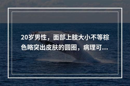 20岁男性，面部上肢大小不等棕色略突出皮肤的圆圈，病理可见角