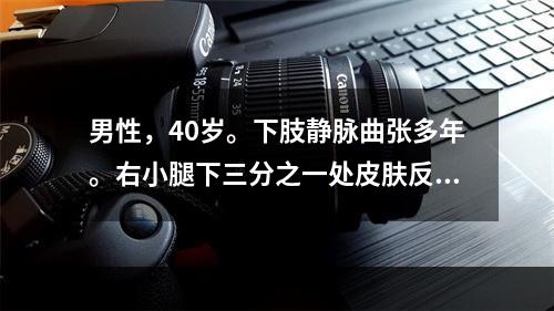 男性，40岁。下肢静脉曲张多年。右小腿下三分之一处皮肤反复发