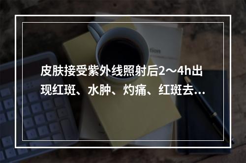 皮肤接受紫外线照射后2～4h出现红斑、水肿、灼痛、红斑去高出