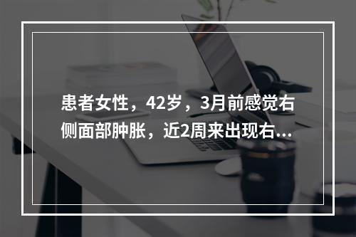 患者女性，42岁，3月前感觉右侧面部肿胀，近2周来出现右面部