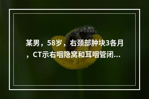 某男，58岁，右颈部肿块3各月，CT示右咽隐窝和耳咽管闭塞，