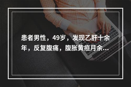 患者男性，49岁，发现乙肝十余年，反复腹痛，腹胀黄疸月余，C