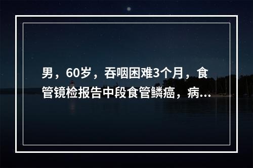 男，60岁，吞咽困难3个月，食管镜检报告中段食管鳞癌，病变长