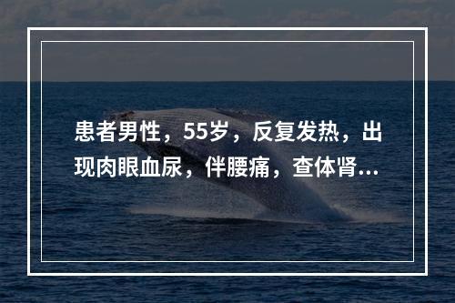 患者男性，55岁，反复发热，出现肉眼血尿，伴腰痛，查体肾区叩