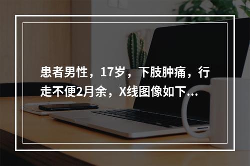 患者男性，17岁，下肢肿痛，行走不便2月余，X线图像如下，最