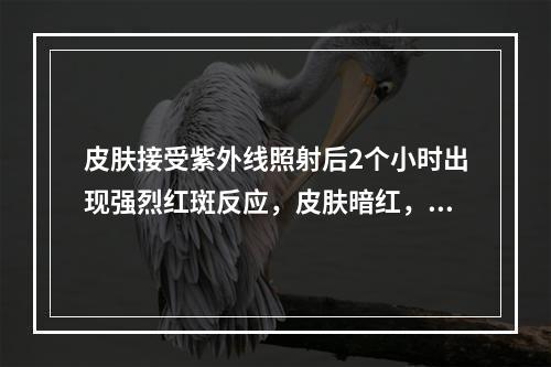 皮肤接受紫外线照射后2个小时出现强烈红斑反应，皮肤暗红，水肿