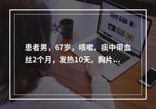 患者男，67岁，咳嗽、痰中带血丝2个月，发热10天。胸片显示