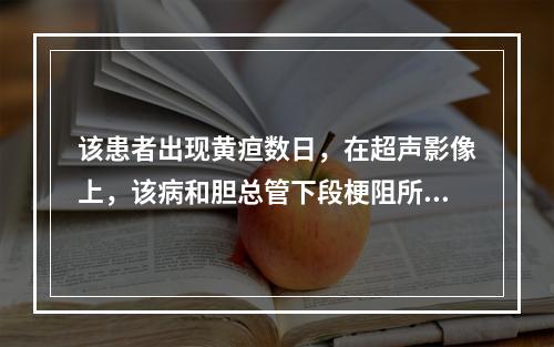 该患者出现黄疸数日，在超声影像上，该病和胆总管下段梗阻所致胆