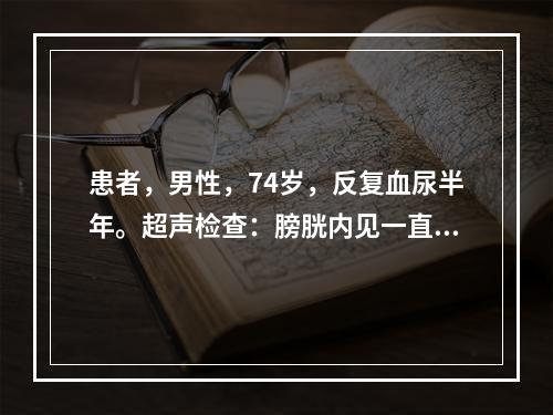 患者，男性，74岁，反复血尿半年。超声检查：膀胱内见一直径2