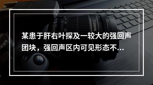 某患于肝右叶探及一较大的强回声团块，强回声区内可见形态不规则