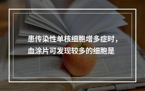 患传染性单核细胞增多症时，血涂片可发现较多的细胞是