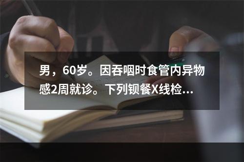 男，60岁。因吞咽时食管内异物感2周就诊。下列钡餐X线检查表