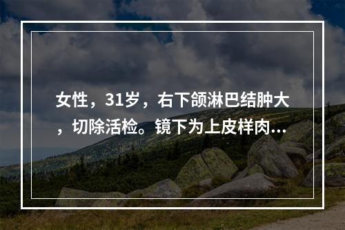 女性，31岁，右下颌淋巴结肿大，切除活检。镜下为上皮样肉芽