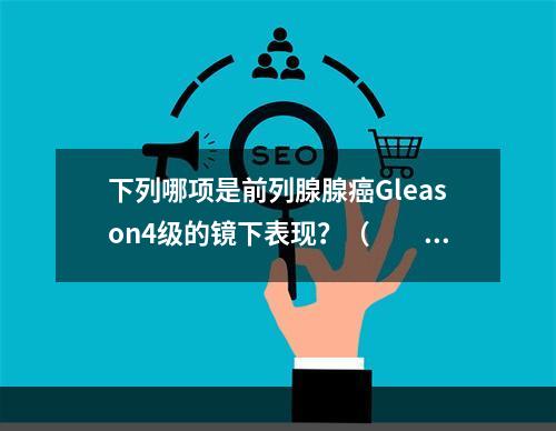 下列哪项是前列腺腺癌Gleason4级的镜下表现？（　　）