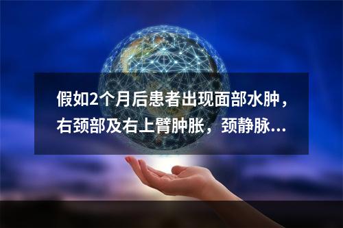 假如2个月后患者出现面部水肿，右颈部及右上臂肿胀，颈静脉及胸