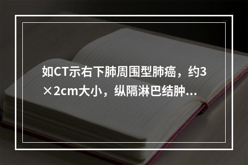 如CT示右下肺周围型肺癌，约3×2cm大小，纵隔淋巴结肿大，