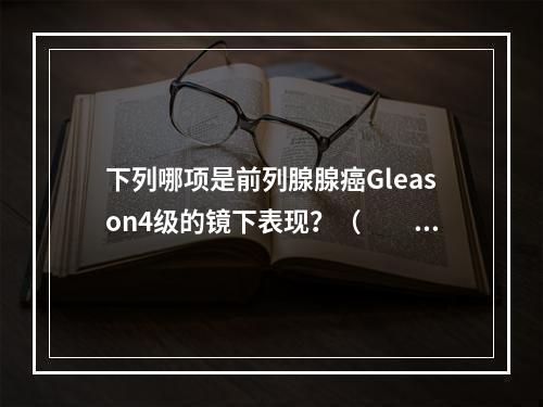 下列哪项是前列腺腺癌Gleason4级的镜下表现？（　　）