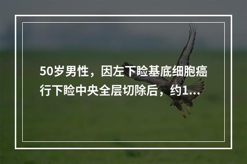 50岁男性，因左下睑基底细胞癌行下睑中央全层切除后，约1／3