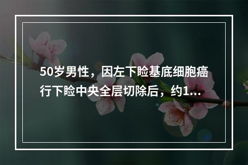 50岁男性，因左下睑基底细胞癌行下睑中央全层切除后，约1／3