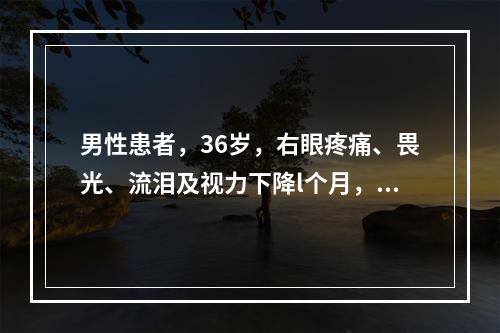 男性患者，36岁，右眼疼痛、畏光、流泪及视力下降l个月，诊断