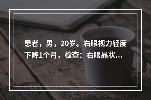 患者，男，20岁。右眼视力轻度下降1个月。检查：右眼晶状体前