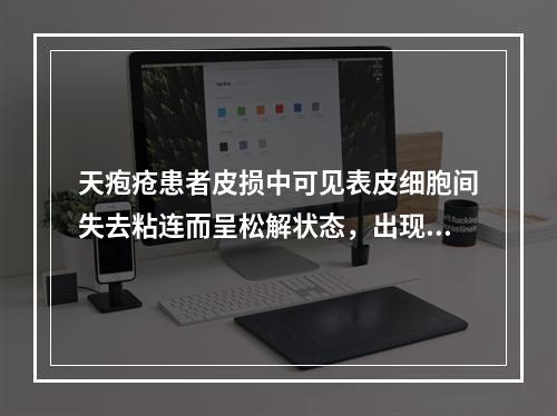 天疱疮患者皮损中可见表皮细胞间失去粘连而呈松解状态，出现表皮