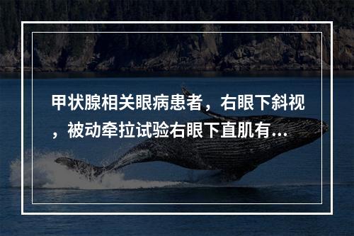 甲状腺相关眼病患者，右眼下斜视，被动牵拉试验右眼下直肌有明显