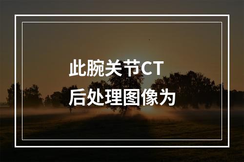 此腕关节CT后处理图像为