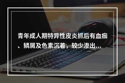 青年成人期特异性皮炎抓后有血痂、鳞屑及色素沉着，较少渗出。由