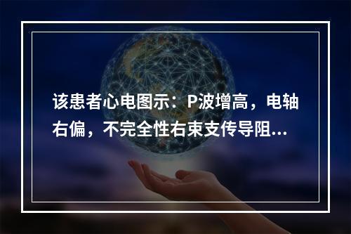 该患者心电图示：P波增高，电轴右偏，不完全性右束支传导阻滞。