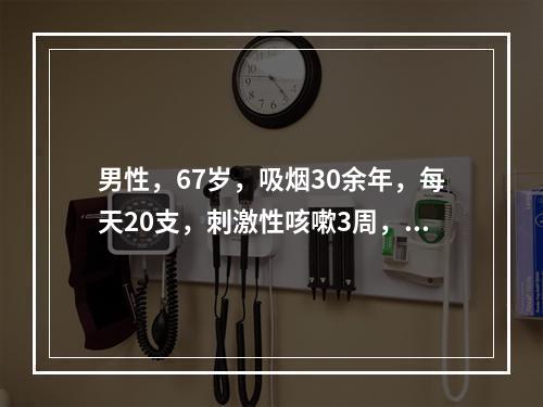 男性，67岁，吸烟30余年，每天20支，刺激性咳嗽3周，呈