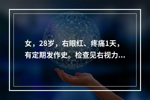 女，28岁，右眼红、疼痛1天，有定期发作史。检查见右视力1.