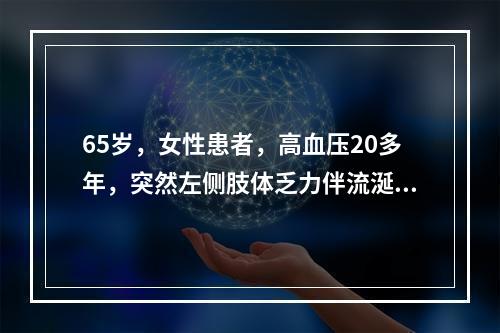 65岁，女性患者，高血压20多年，突然左侧肢体乏力伴流涎、