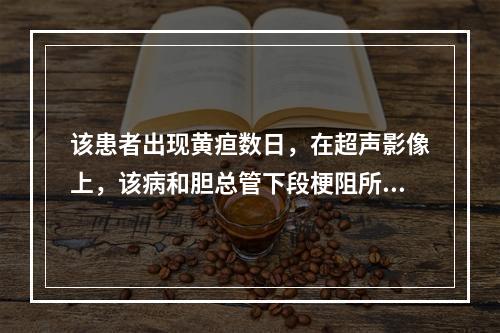 该患者出现黄疸数日，在超声影像上，该病和胆总管下段梗阻所致胆