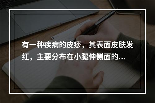 有一种疾病的皮疹，其表面皮肤发红，主要分布在小腿伸侧面的结节