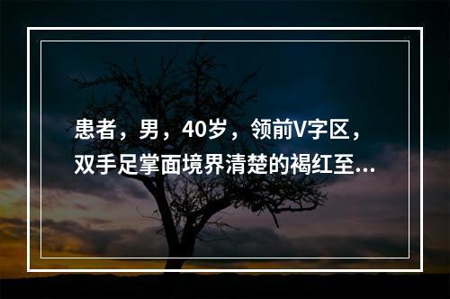 患者，男，40岁，领前V字区，双手足掌面境界清楚的褐红至褐黑