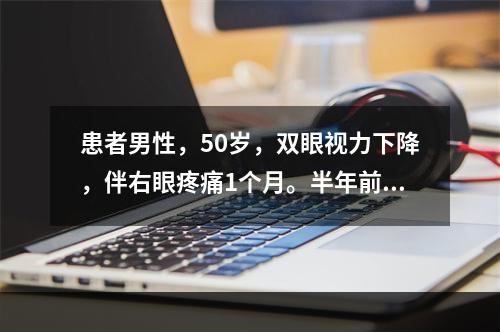 患者男性，50岁，双眼视力下降，伴右眼疼痛1个月。半年前右眼