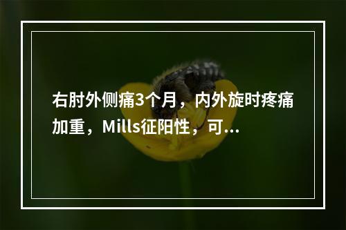 右肘外侧痛3个月，内外旋时疼痛加重，Mills征阳性，可考虑