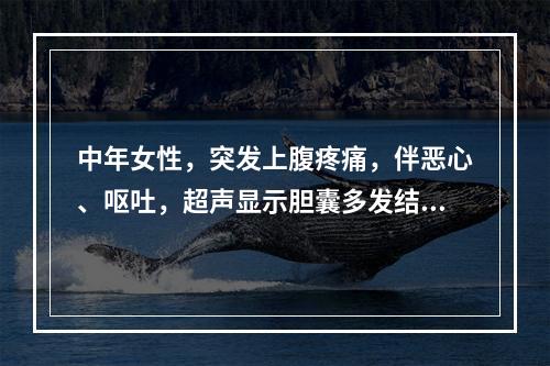 中年女性，突发上腹疼痛，伴恶心、呕吐，超声显示胆囊多发结石