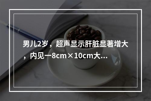 男儿2岁，超声显示肝脏显著增大，内见一8cm×10cm大小