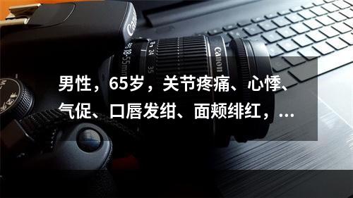 男性，65岁，关节疼痛、心悸、气促、口唇发绀、面颊绯红，肝