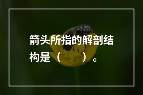 箭头所指的解剖结构是（　　）。